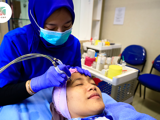 Cara Menghilangkan Melasma