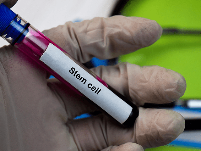 Stem Cell untuk Kecantikan