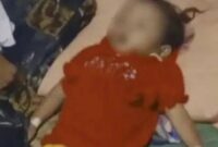 Seorang balita bernama Raya di Kabupaten Sukabumi, Jawa Barat, meminggal dunia dengan tubuh penuh cacing. (Foto: Video Capture Rumah Teduh)