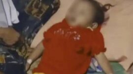 Seorang balita bernama Raya di Kabupaten Sukabumi, Jawa Barat, meminggal dunia dengan tubuh penuh cacing. (Foto: Video Capture Rumah Teduh)