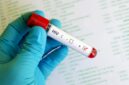 Kemenkes memperkuat deteksi dini HIV sekaligus mengajak masyarakat menghentikan stigma terhadap ODHIV. (Foto: Kemenkes)