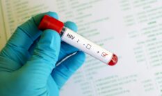 Kemenkes Luruskan Kasus HIV Sidoarjo: Banyak Terdeteksi Bukan Berarti Penularan Naik