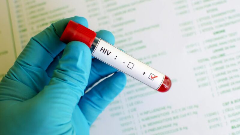 Kemenkes memperkuat deteksi dini HIV sekaligus mengajak masyarakat menghentikan stigma terhadap ODHIV. (Foto: Kemenkes)