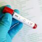 Kemenkes memperkuat deteksi dini HIV sekaligus mengajak masyarakat menghentikan stigma terhadap ODHIV. (Foto: Kemenkes)