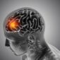 Deteksi lebih awal menjadi kunci menahan stroke sebelum merenggut kualitas hidup. (Foto: Freepik)