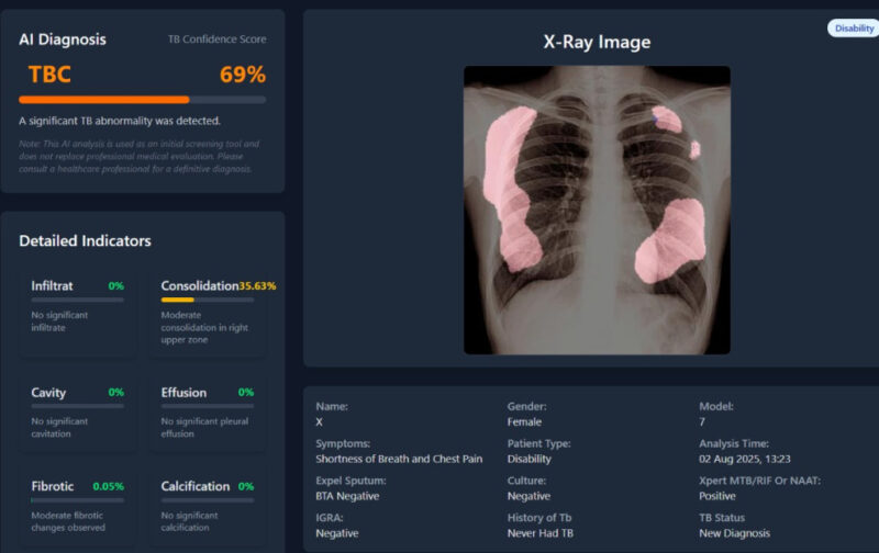 Teknologi AI dikembangkan untuk membantu mempercepat deteksi TBC hingga menjangkau wilayah terpencil dan kelompok rentan. (Foto: TBScreen.AI Research Team/UGM)